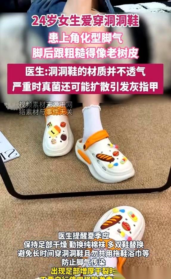 一脱鞋，脚后跟糙得像两块陈年老树皮。涂了半个月的润肤霜，连条缝都没糊平。小怡没