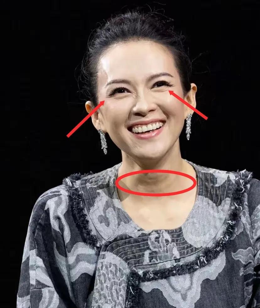 不好意思，我真的没法同情章子怡！原因很简单，虽然她和汪峰离婚了，眼角有皱纹，