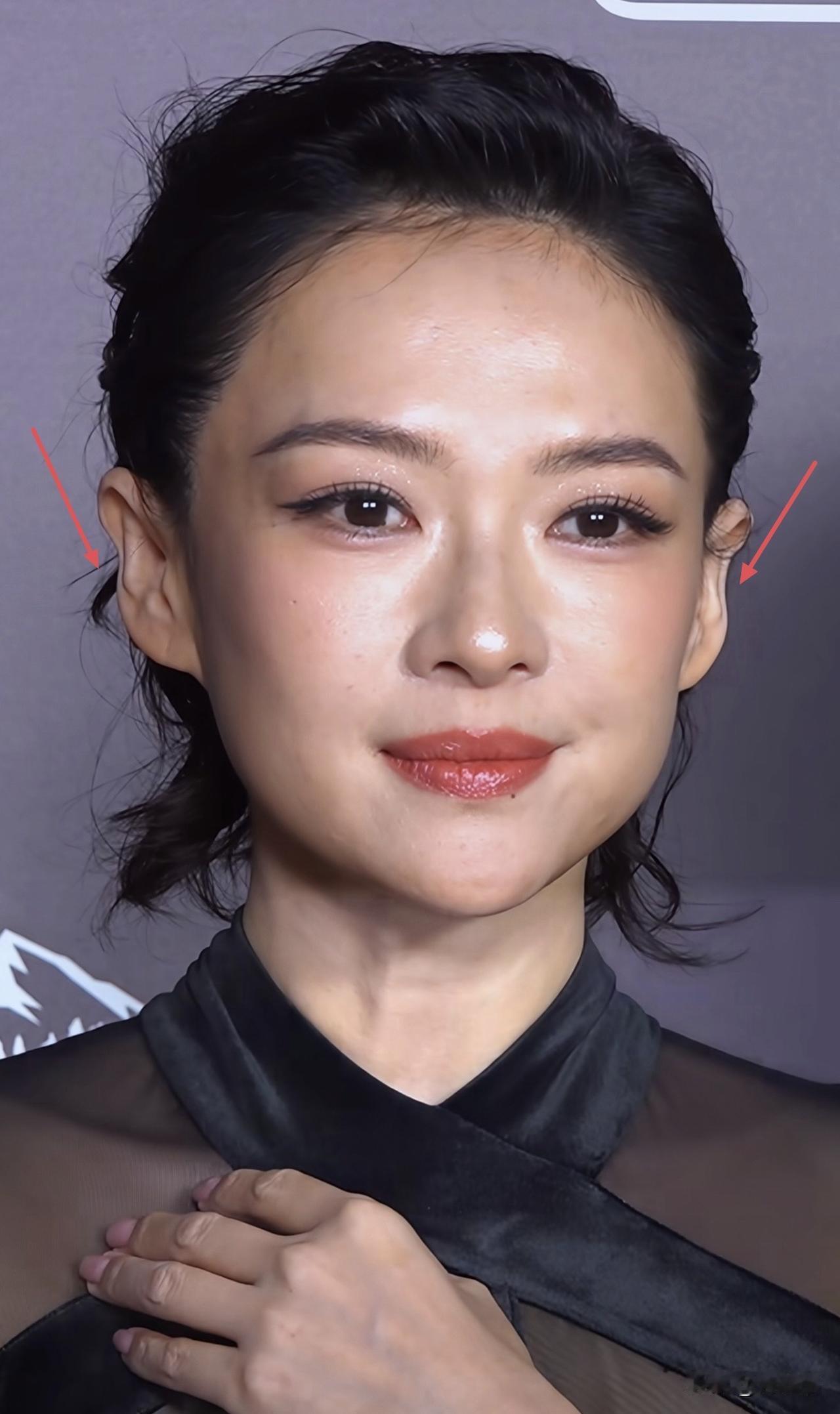 女明星上了年纪后，会走上医美馒化这条路不稀奇，章子怡比较神奇的是，耳朵好像也跟着