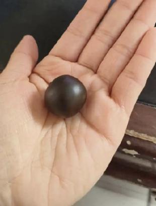 自己乱吃“多子丸”，真怀上四胞胎，结果还是留不住。江苏这位备孕的姐妹，图省事自