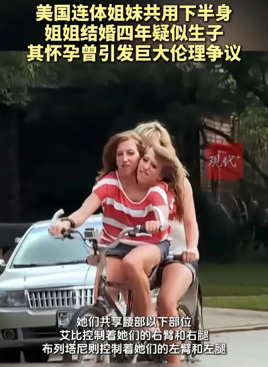 连体姐妹共用下半身结婚生子，孩子究竟算谁的？美国有一对连体姐妹，她们共用下半