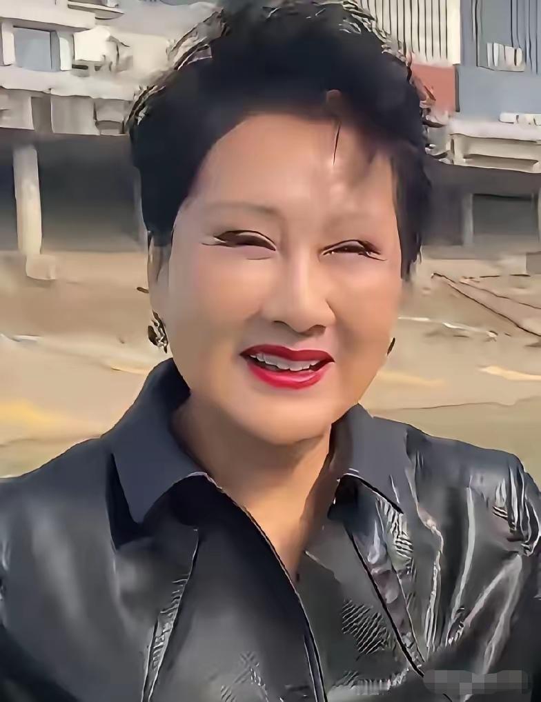 张凯丽的眼睛咋变成这个样子。一双眼睛都眯成了一条缝了。张凯丽以前的原生眼睛可