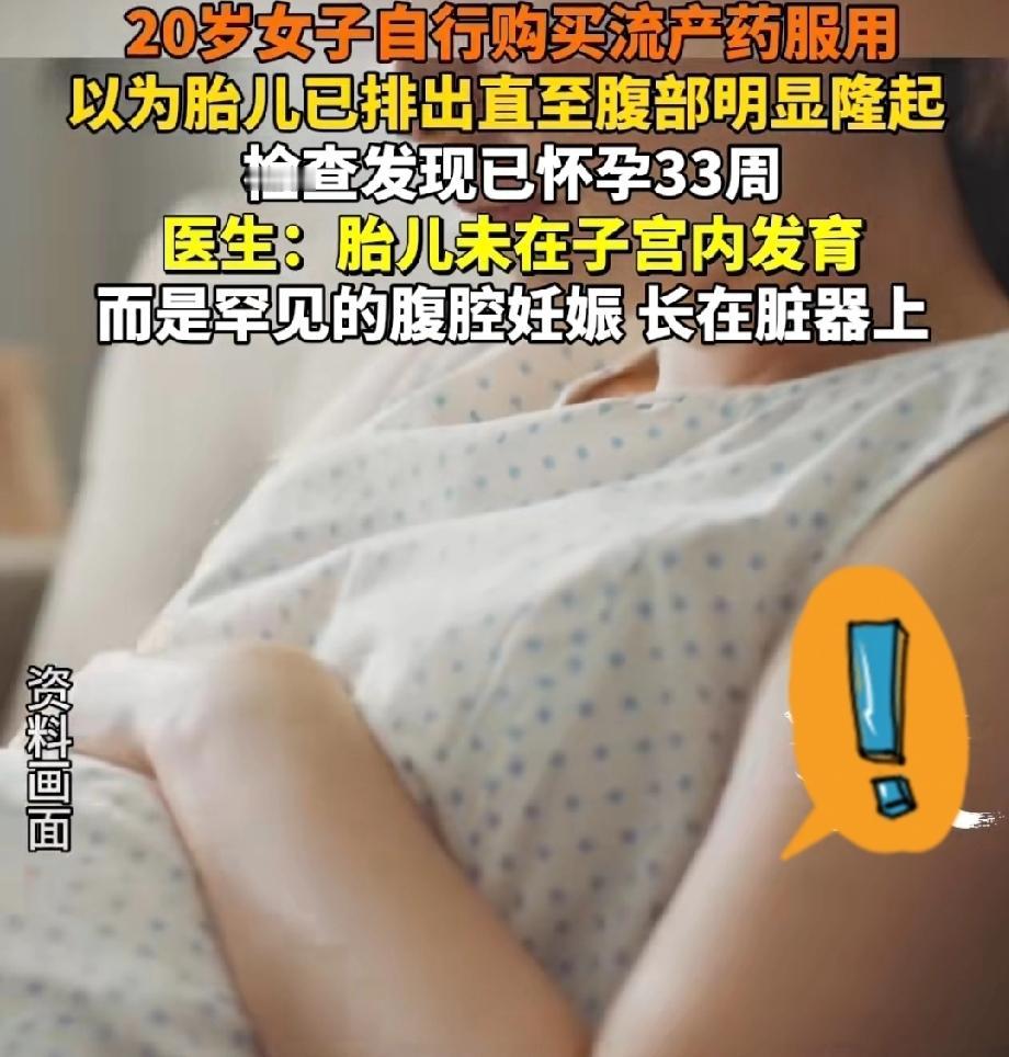 我了个乖！哈尔滨那个自己吃了流产药的女子，后续没有去检查有没有流干净，在腹腔里悄