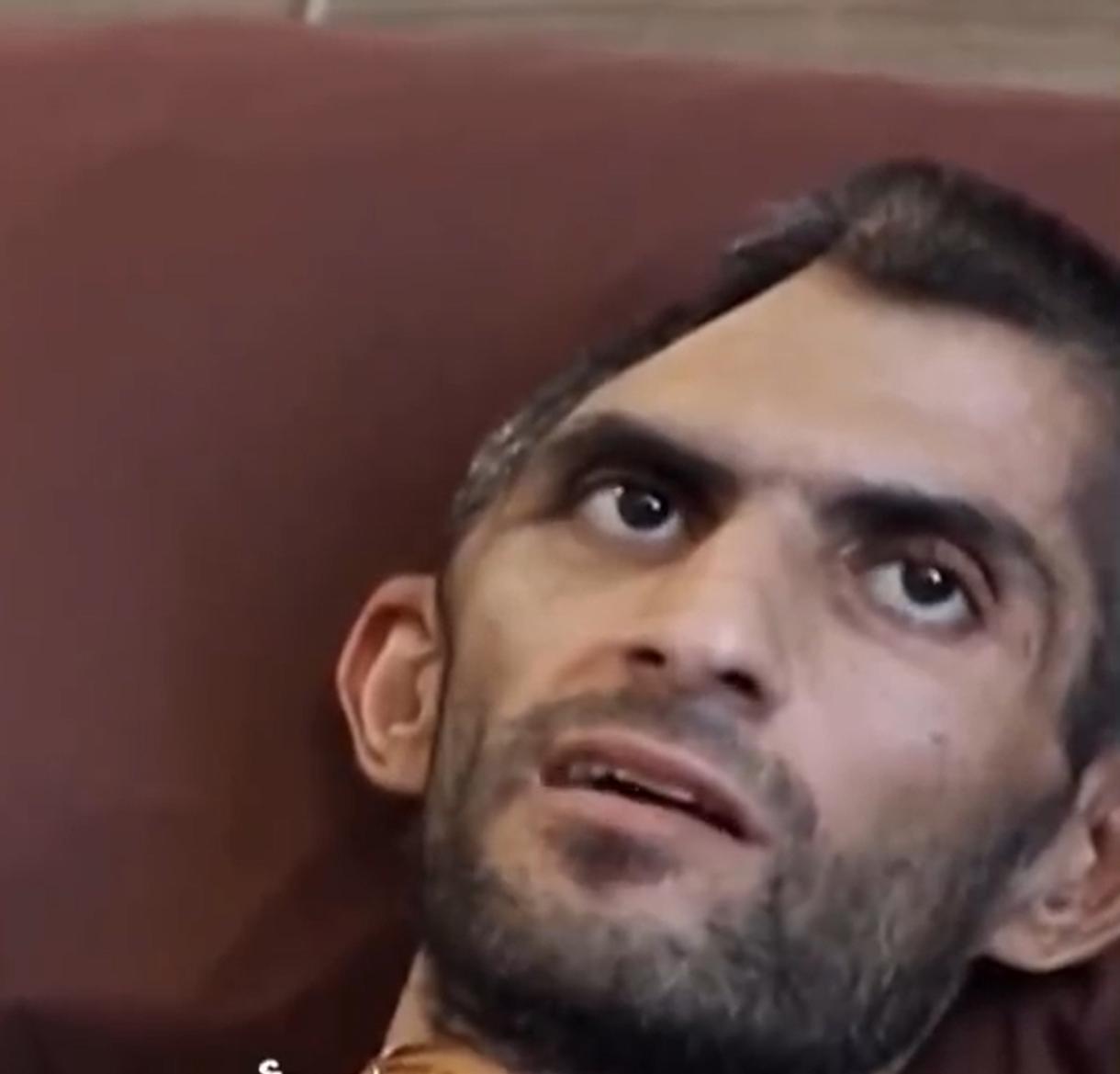 你敢想象，这是同一个人吗？这是巴勒斯坦的一名记者，被以色列关押之后，出来就变