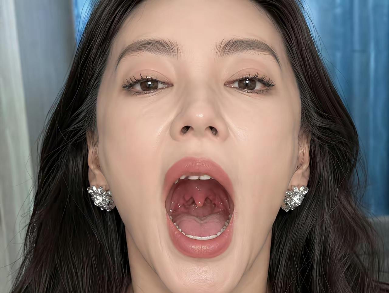 张雨绮正在做“口腔运动”据说长期做，可以增强脸部肌肉弹力。