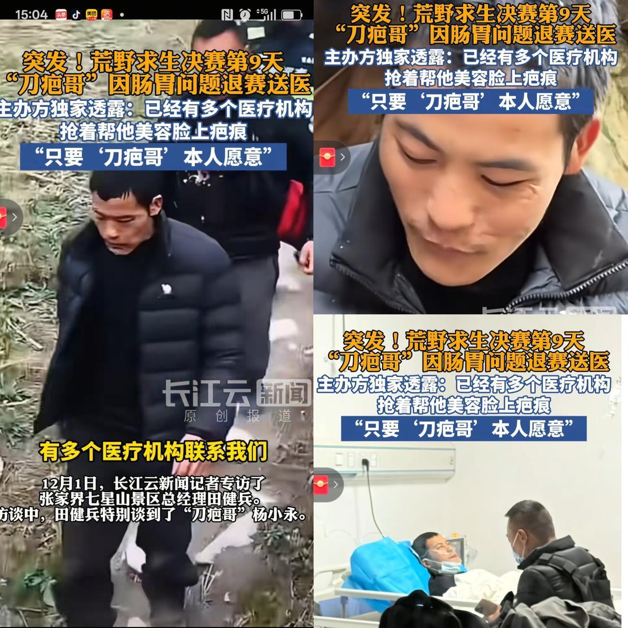 刀疤哥退赛原因:肠胃不适！刀疤哥退赛的信息，官方终于发声，说是肠胃不适，还正