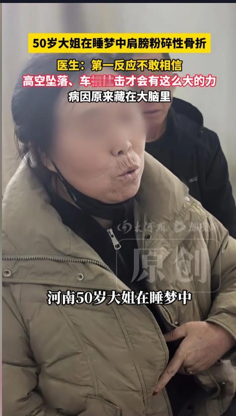 “万万没想到！”近日，河南，一位50岁的女子刚从睡梦中醒来，发现自己骨折了，赶紧