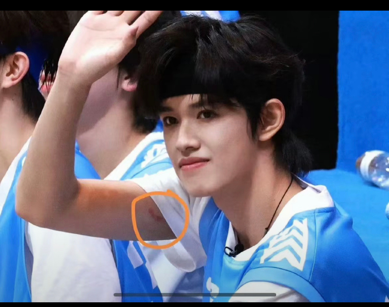 怎么看着那么像牙印