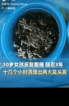 “心太大了!”福建，10岁女孩3年来经常肚子疼，家长带她看了多家医院都没有根治，