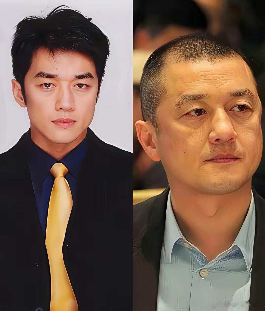 把李亚鹏那段话拆开来听，就能秒懂：国内不缺好牙医、好外科、好心理师，缺的是“一条