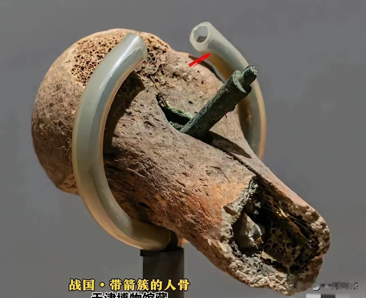 这骨头是战国时期的人骨，距今已经2400年了，在这块骨头上，有一个箭头深深的插在