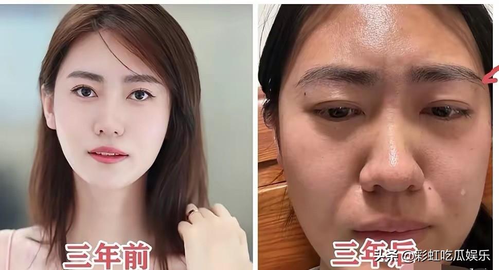 选美冠军阿珍太惨了，跟了胜宏老总三四年让人白嫖了，分手费只有几十万，她已经身败名