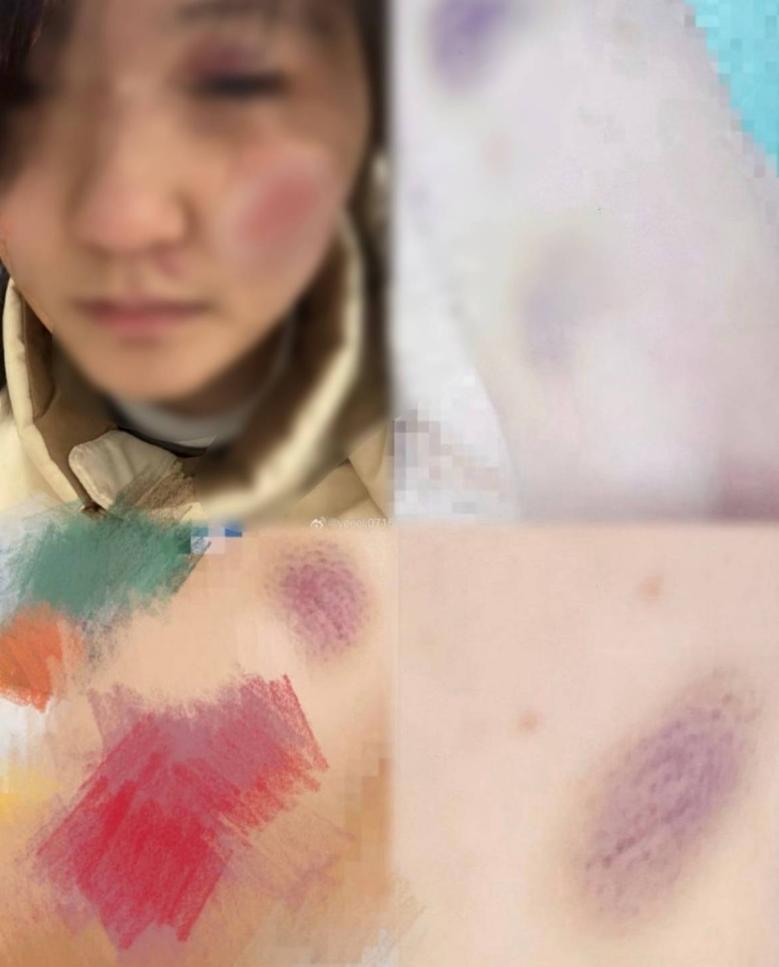 一名17岁未成年女生公开实名举报：江西某大学男生叶某某长期性侵、殴打及精神控制