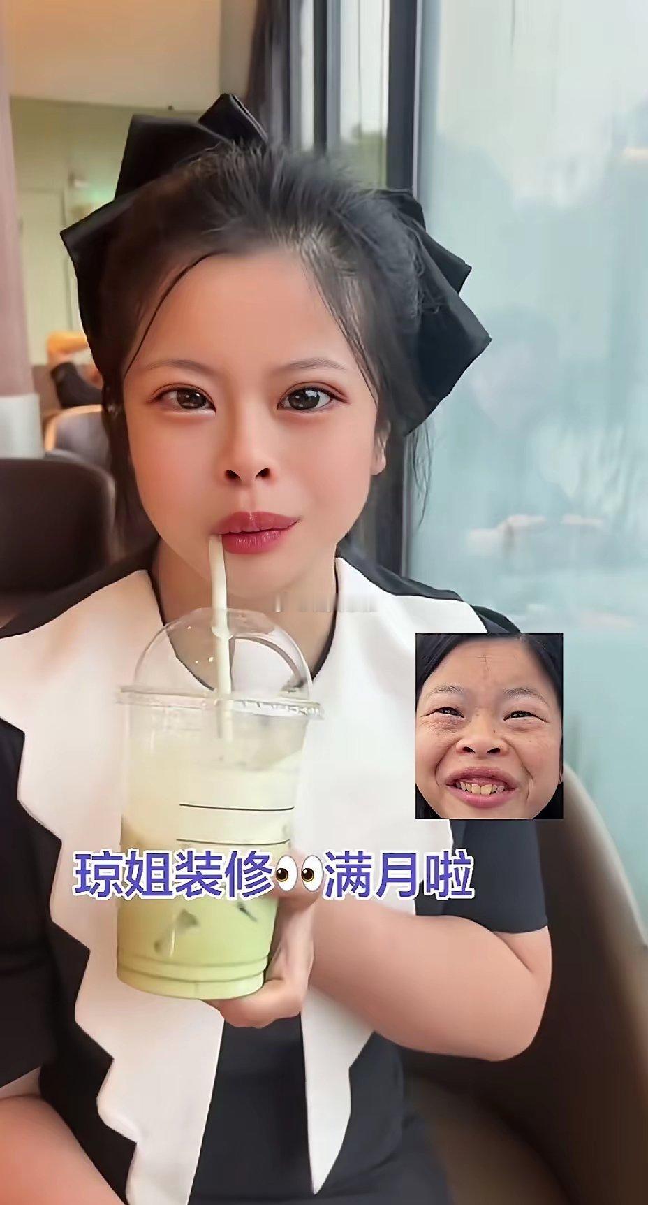 网红琼姐整容太成功了曾经有多丑，如今就有多美美的都快不像一个人