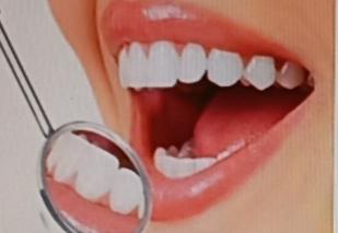 牙疼真的太要命了，不过不用抽，有快速止疼法能让你远离疼痛。我以前牙疼时，就试过不