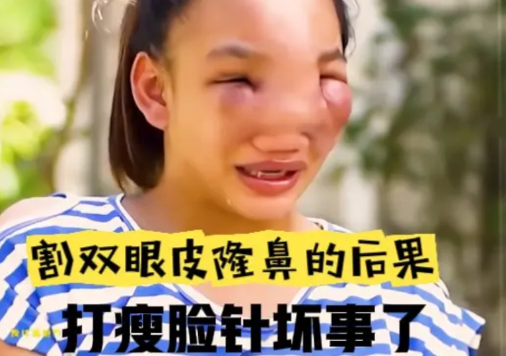 女人本来长得还算漂亮，可是她却不满足，她逼着丈夫借钱给她整容，丈夫拗不过她，就东