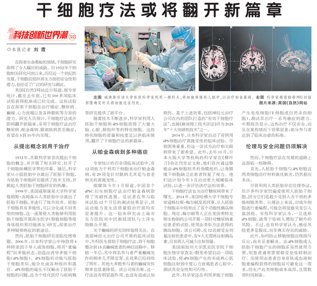 《科技日报》报道: 干细胞疗法或将翻开新篇章