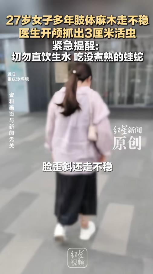 “太吓人了！”近日，重庆，一27岁女子在医院接受了开颅手术，医生竟在里面抓出来一