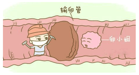 生完二胎后要不要结扎? 网友的回答, 很触动心里!