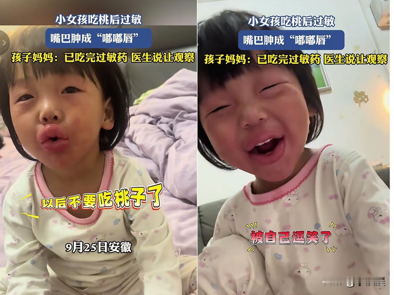 安徽这娃子被亲爹坑惨了，娃嘴唇肿成香肠，眼睛眯成一条缝，看着又可怜又好笑