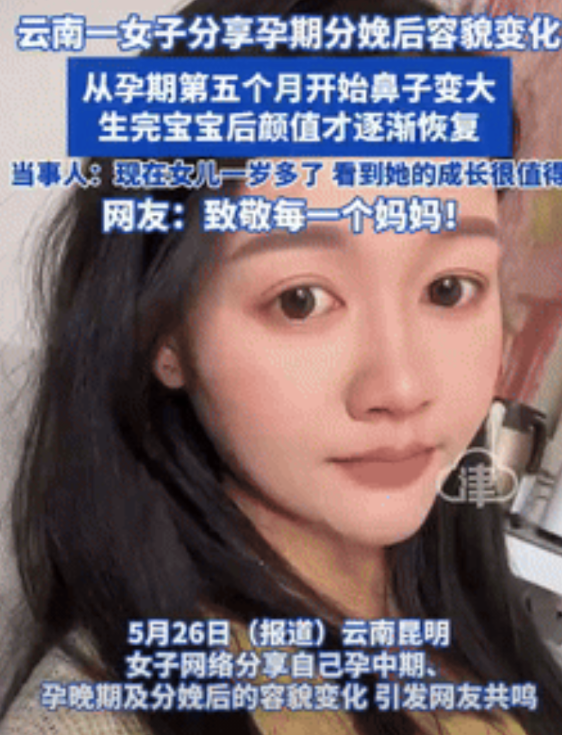 太不容易了！云南，女子怀孕之后不仅发胖，而且到了第五个月，鼻头也开始变大，面容断