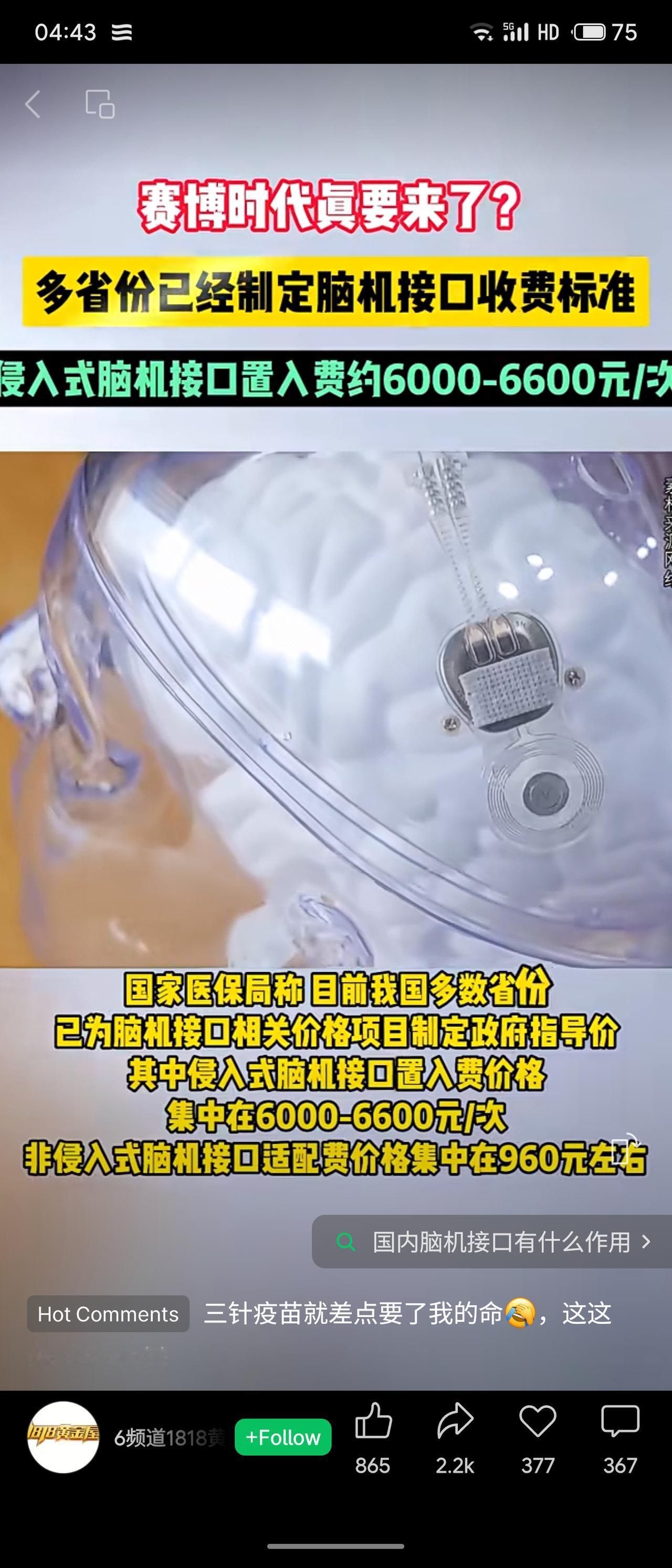 多省份已为脑机接口制定政府指导价：侵入式约6000-6600元/次，非侵入式约9