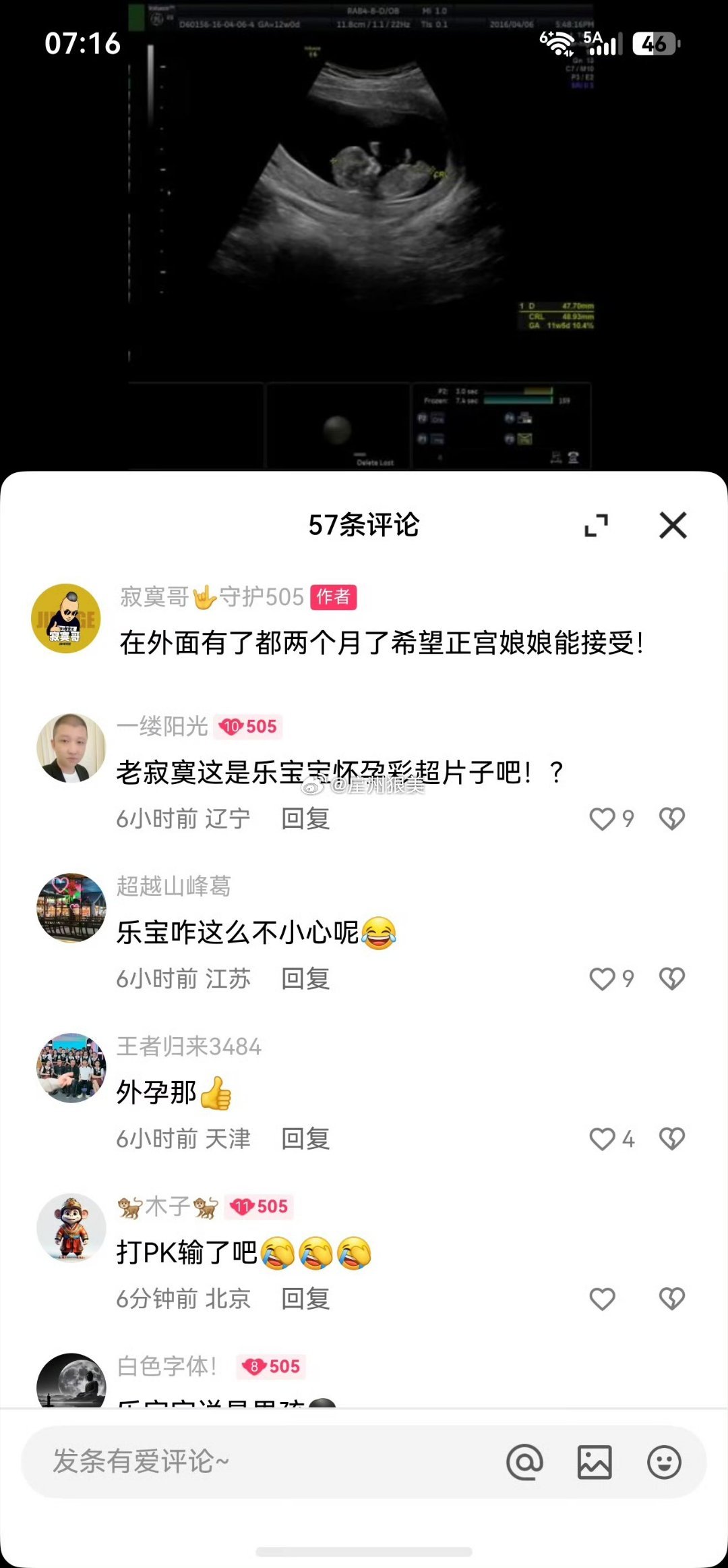 寂寞孩子是你的吗？[笑着哭]​​​