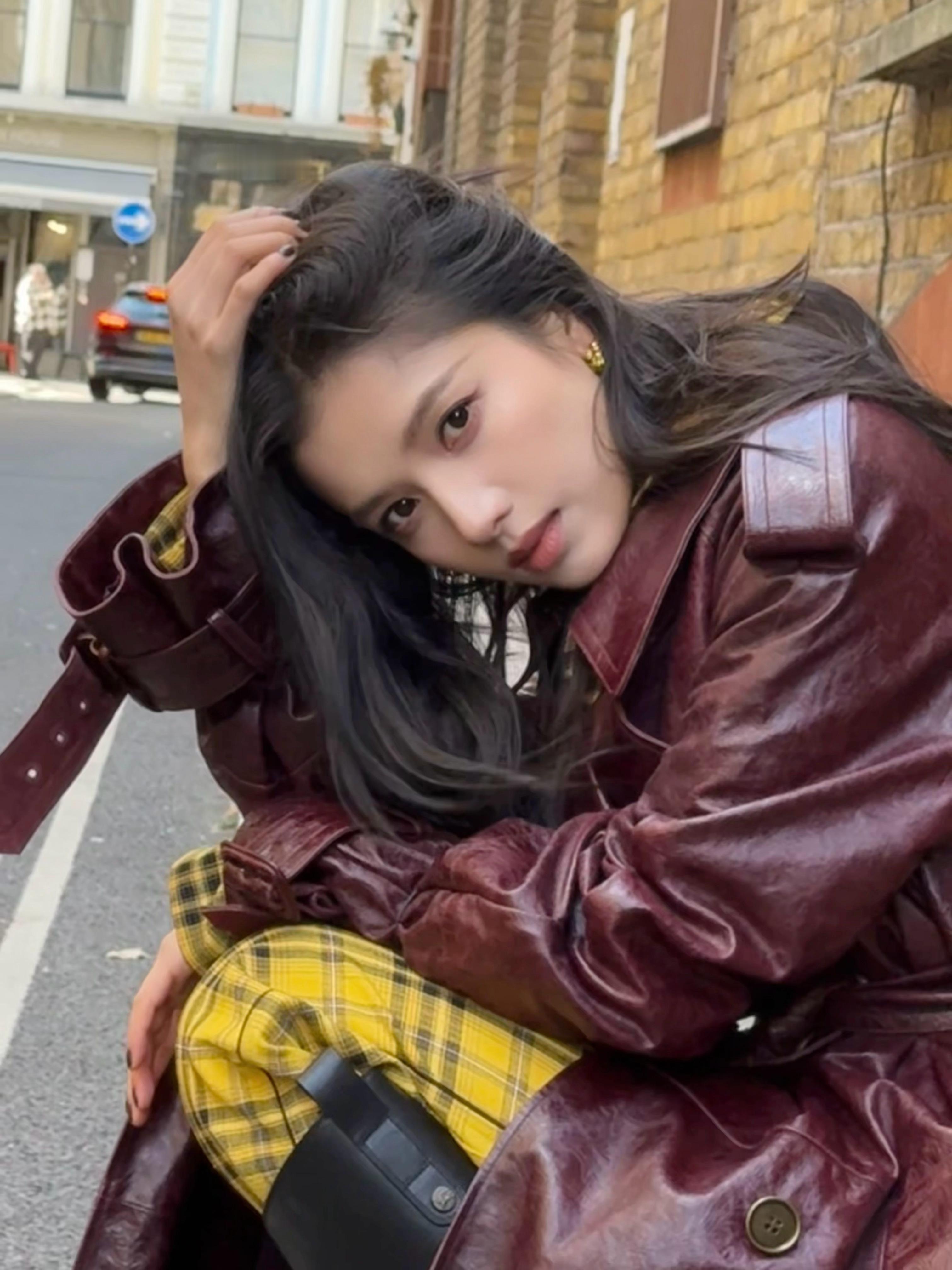 张婧仪脸上起小疹子在复制粘贴的时代，你是手写的诗