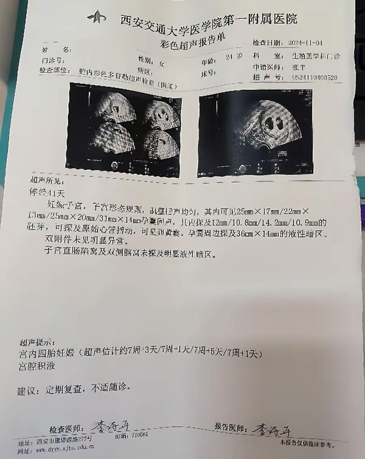 上海有一女子去产检，12月16日报道，结果查出是四胞胎，全家人都高兴得不行。可等