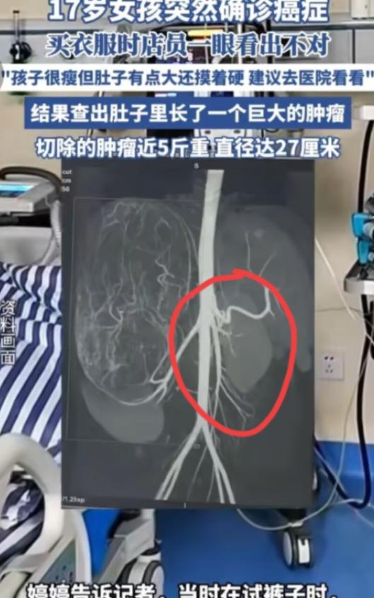 2025年6月，广东17岁女孩和妈妈一起逛街买衣服，在试裤子的时候，老板娘发觉女