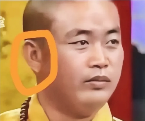 释永信被扒耳垂秘密！[汗]玻尿酸打造
