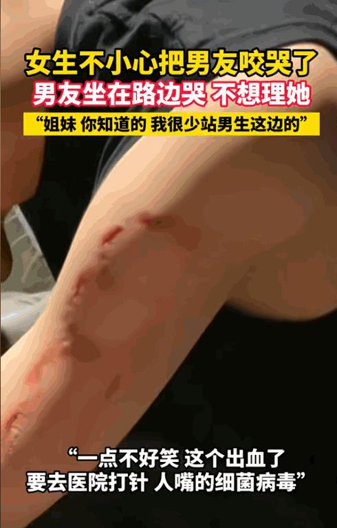 “心太狠了！”女生和男朋友出去约会，却无缘无故张口去咬男朋友手臂，把男朋友咬得坐