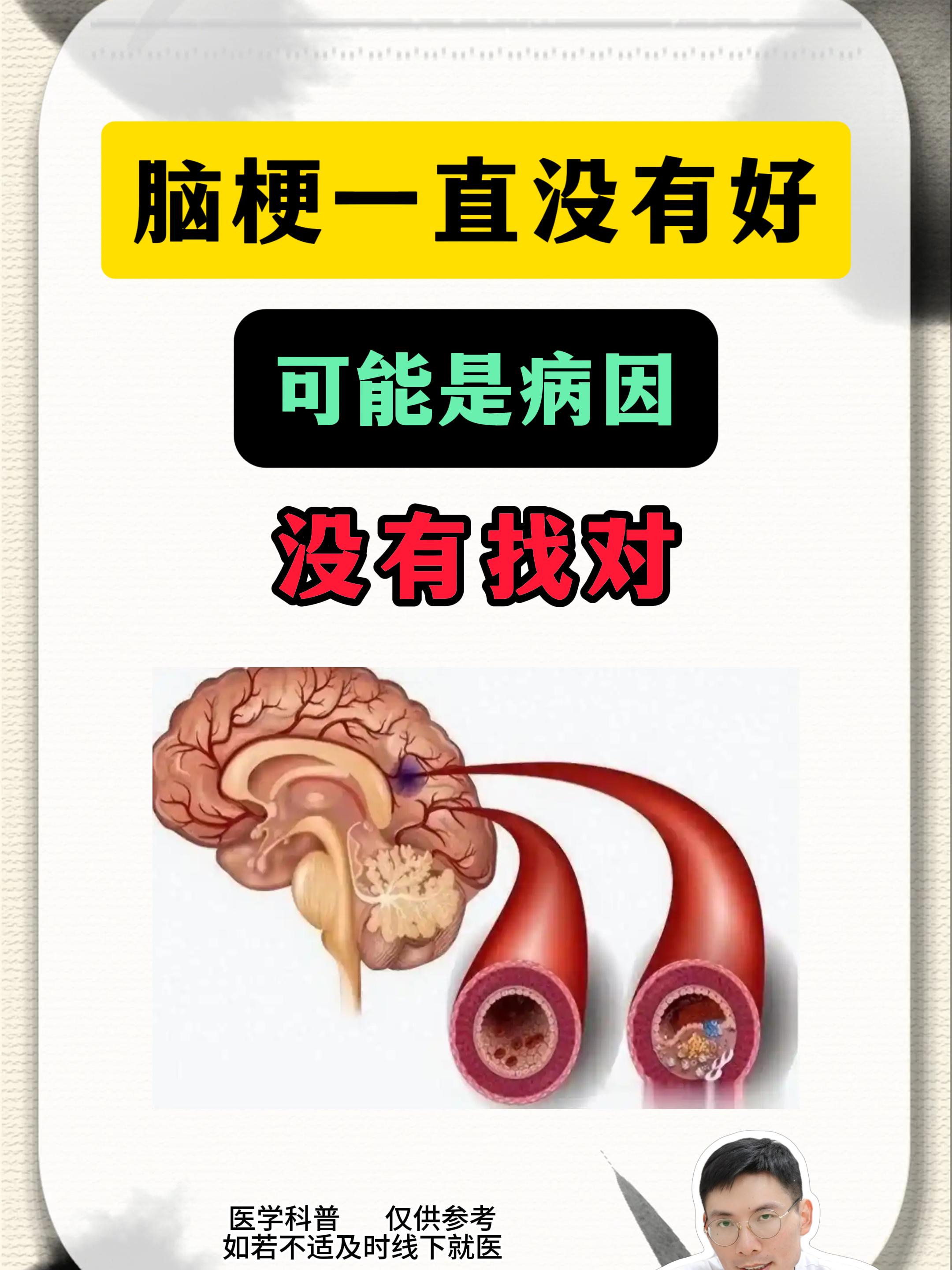 脑梗后遗症   健康科普知识   脑梗   脑梗塞