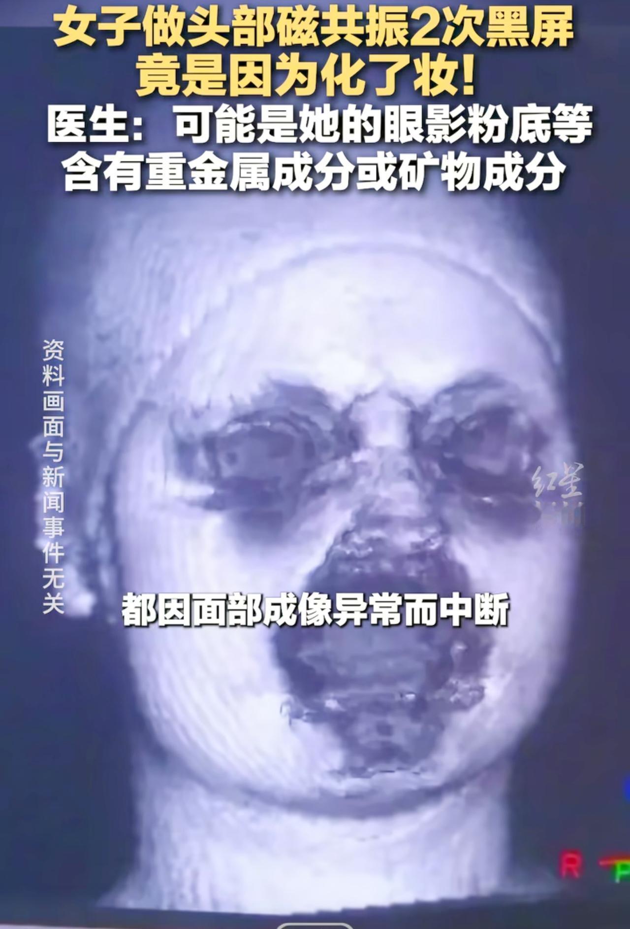 福建这事儿，看得我后背发凉。29岁姑娘化着淡妆去做核磁，几千万的精密仪器直接
