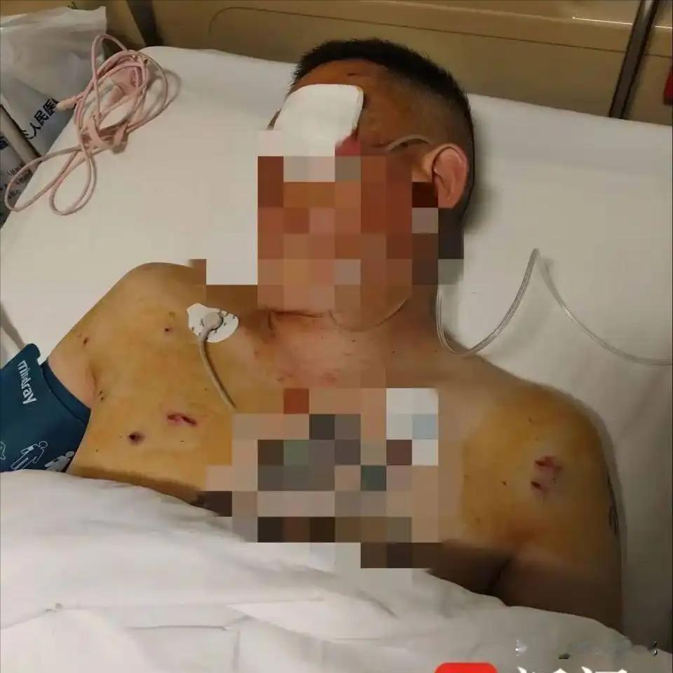 170万啊！就在银行眼皮子底下被抢，银行保安就跟看热闹似的，连动个手指头