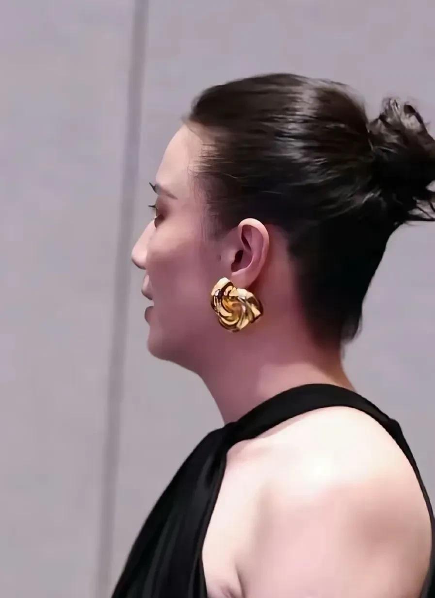 真实的宋佳，治好了我的焦虑