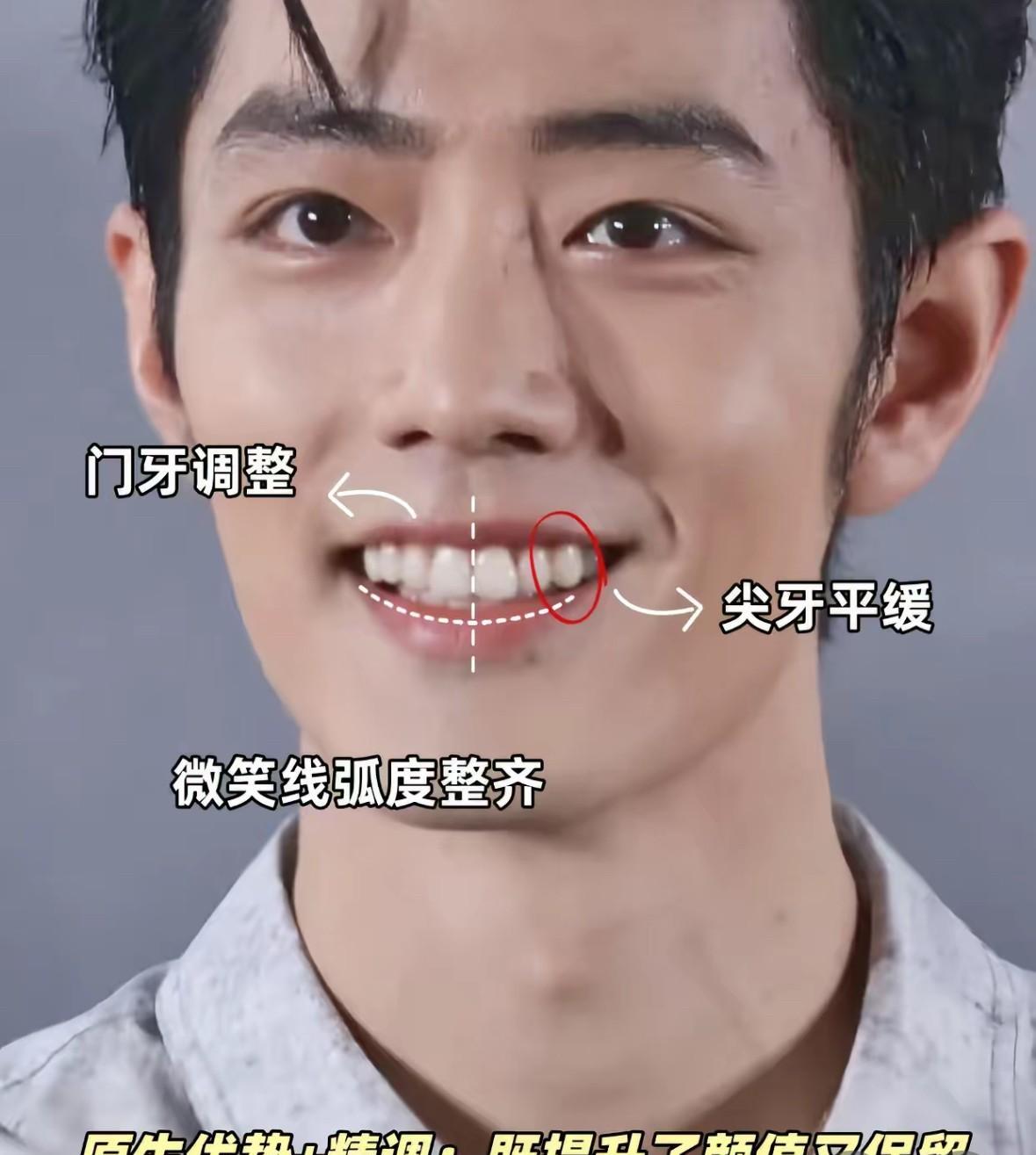 牙齿对容貌的影响有多大？来看肖战就知道了早期的兔牙已不在，调整后的牙齿更整齐