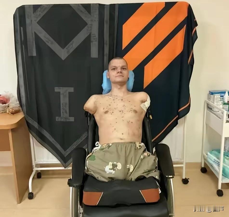 太令人心寒了这不是人彘，这是乌克兰受伤的士兵他失去了手脚，在后方却又被同胞羞