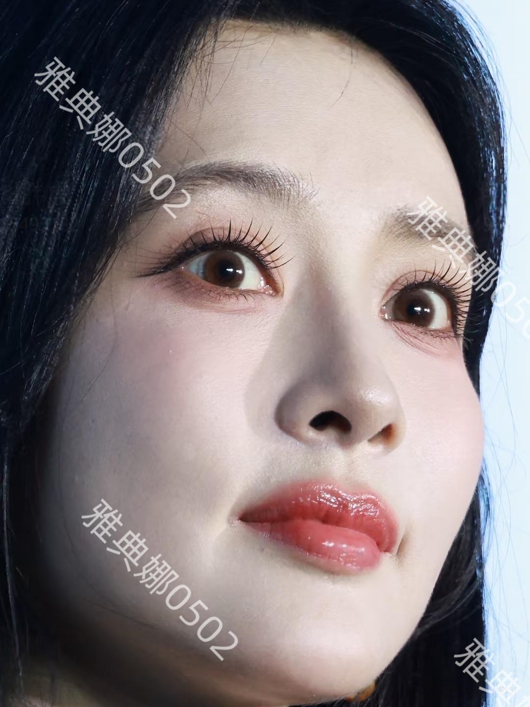 一直get不到孟子义的美，感觉她每一个五官都明显有人工调整的痕迹，眼角开的太大了