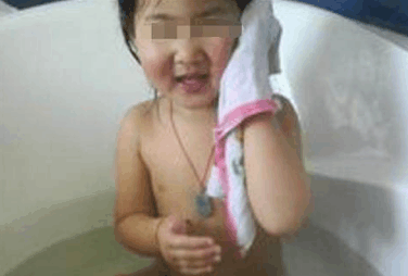 洗澡时发现孩子腹中有硬块, 妈妈的谨慎挽救了孩子性命