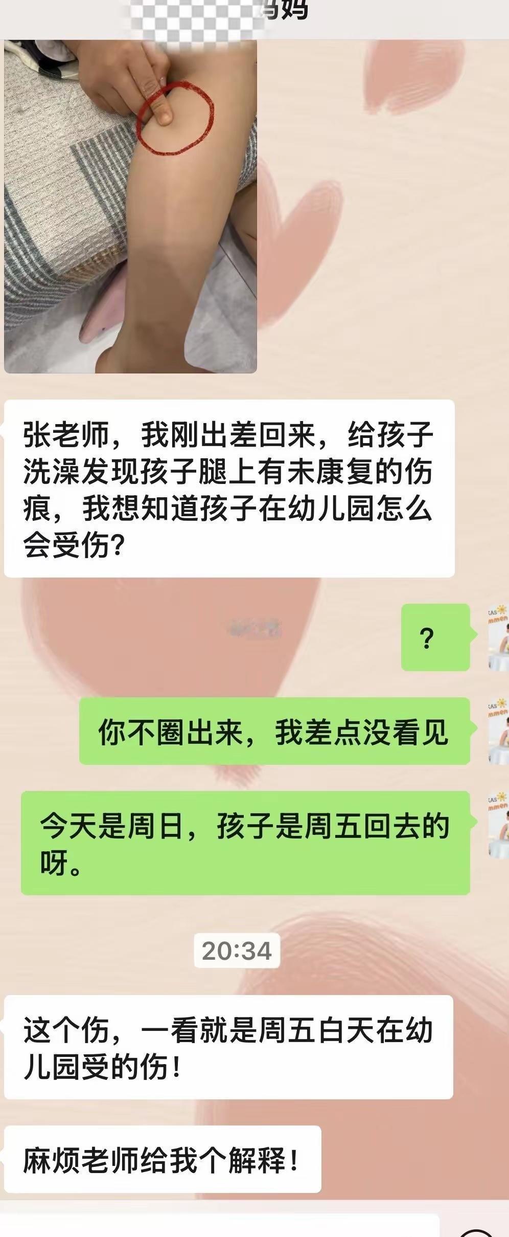 手指头怎么了？