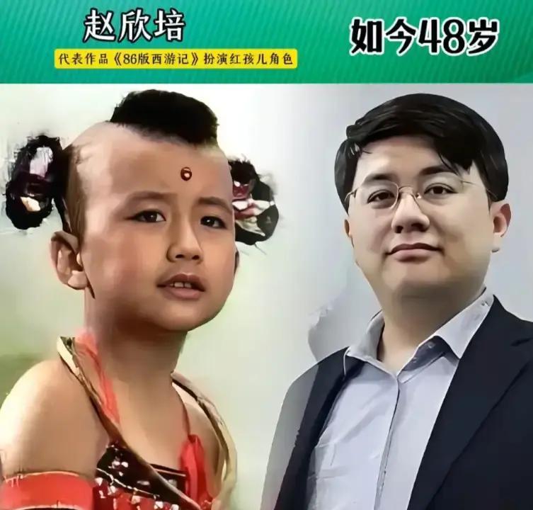 三毛秃顶直播卖生发水：这哪是毁童年，分明是揭开了成年人的“遮羞布”！26年前，