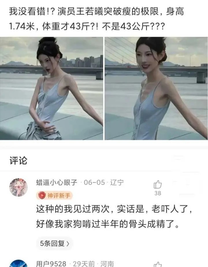 这样的瘦真的美吗？