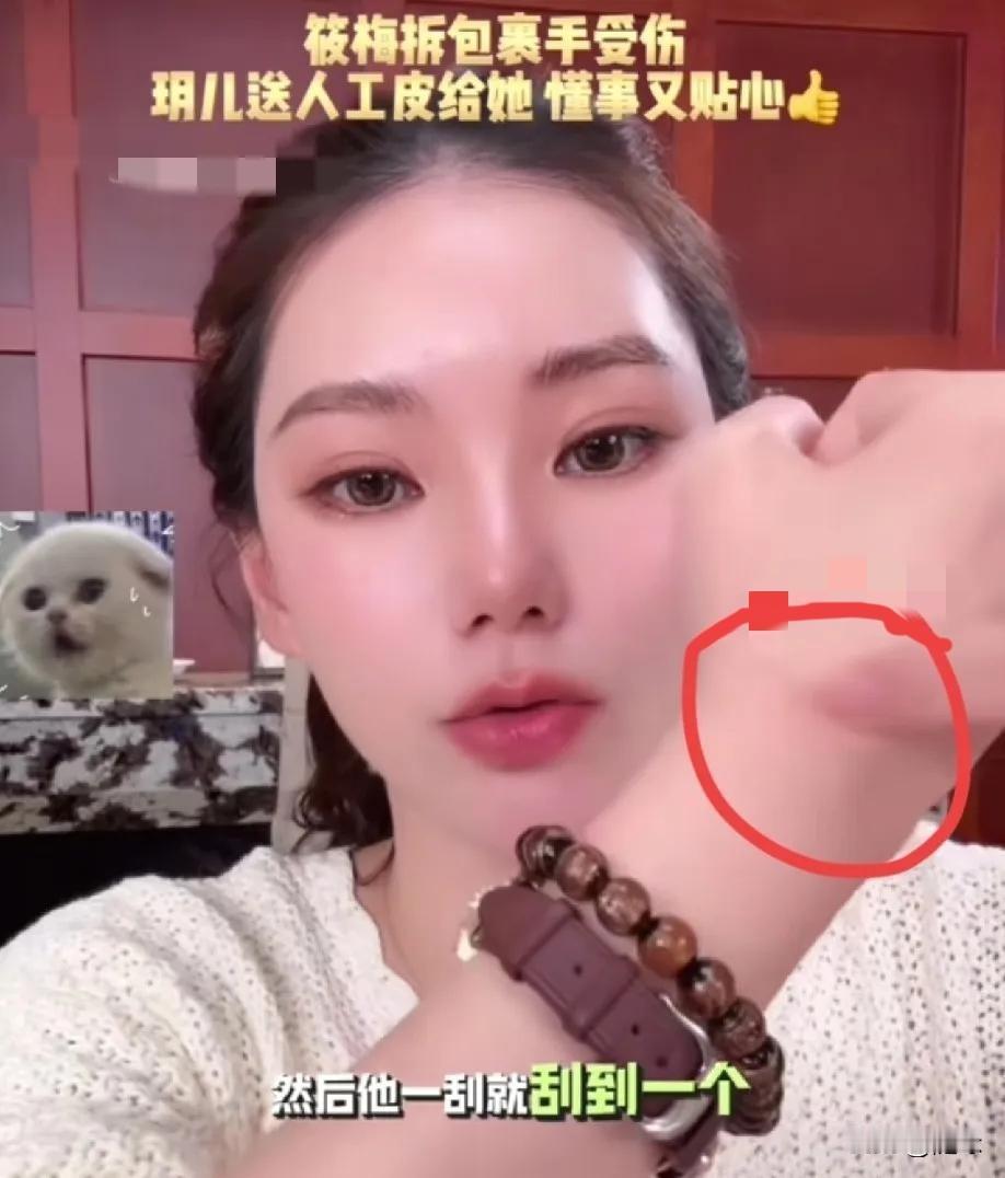 果然是后妈难当！马筱梅直播，有细心的网友发现，她手腕上有一道疤痕，关心问怎么回