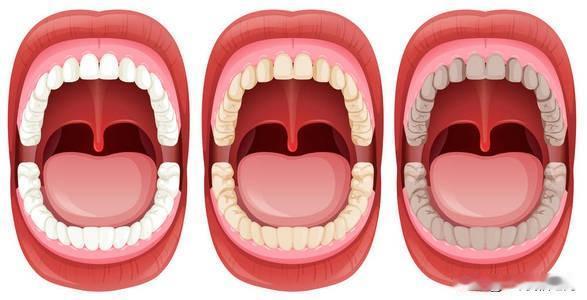 口臭该怎么解决首先要了解口臭原因口臭主要有几个原因：第一，生理性的口臭一