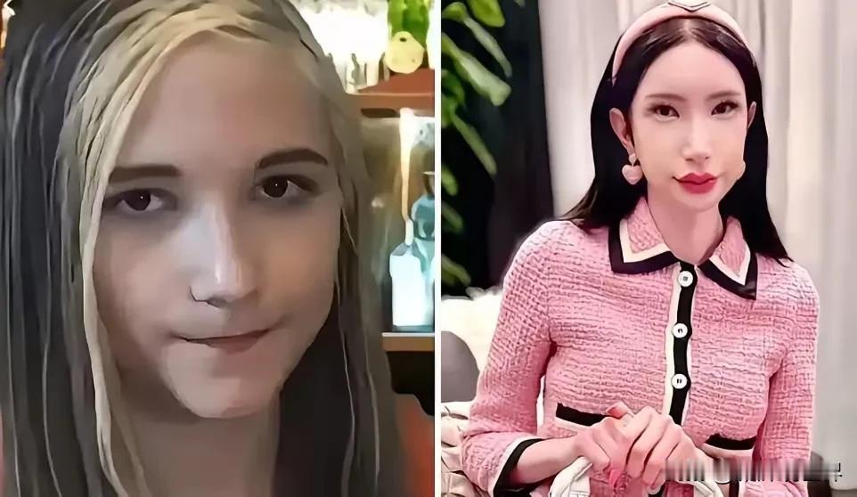 不要再盲目崇拜韩国整容术了！看把好好的一个混血儿大美女，活活整成一个吓死