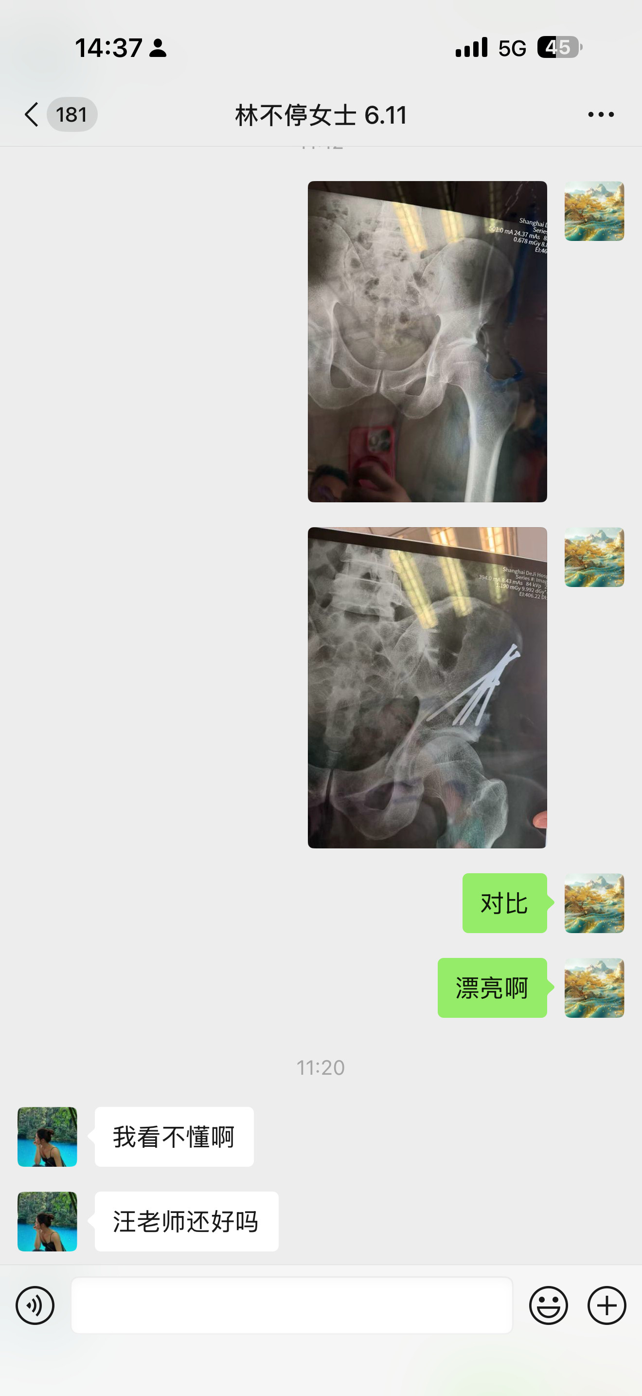 要不都说久病成医呢？今天一个病房都去拍术后x光了，是三个人同时拿着片子躺在床上认