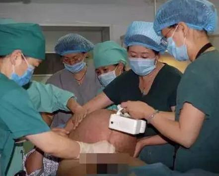 剖腹产并不是在肚子上划一刀那么简单, 男人有什么理由不疼惜