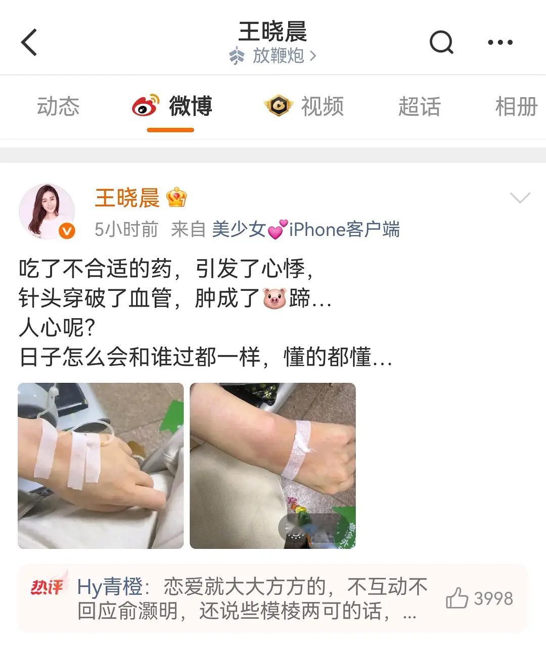 王晓晨发文好像话里有话，她和俞灏明怎么了？