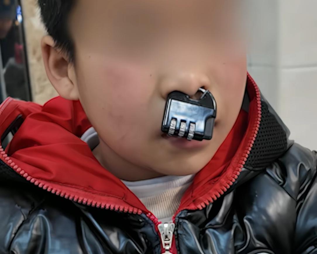 看到新闻，小朋友把密码锁锁在自己鼻子上，消防员去帮忙剪🔒了，剪了以后，消防员问